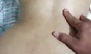 in anal prolapse wif ...