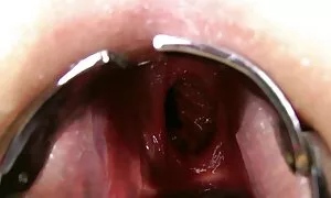 ho otla ka makhetlo  ...