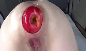 anal fisting fetelet ...