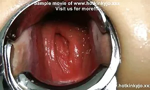 Mapolesa a masene a  ...